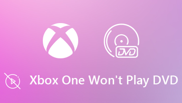 Fix Xbox One spielt DVD-Fehler nicht ab