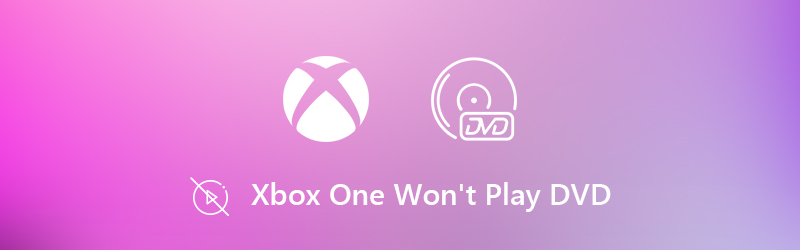 Xbox One spielt keine DVD ab